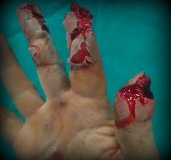 petardele-sunt-periculoase