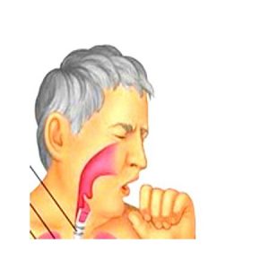 tuse-convulsiva-tuse-magareasca
