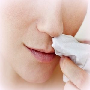 hemoragie-nazala-epistaxis