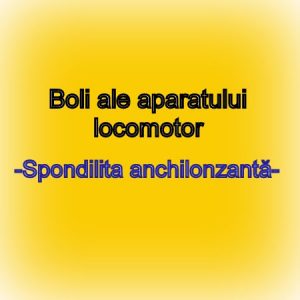 spondilita-anchilonzanta