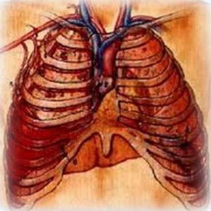 hemotorax