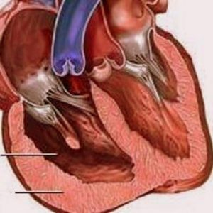 cordul-pulmonar-cronic