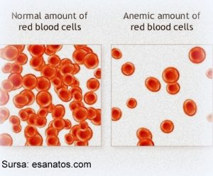 anemiile-boli-ale-sangelui
