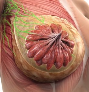 Mastoza fibrochistică (boala Reclus)