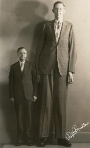 Gigantismul