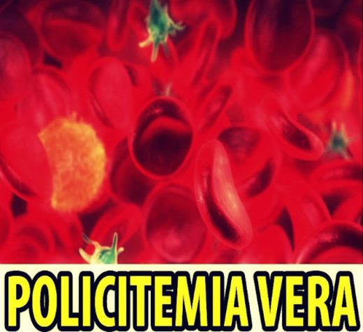 Policitemia vera (boala Vaquez-Osler)