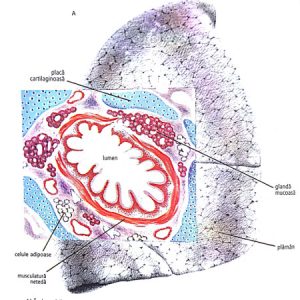 fibroza-chistica-microviscidoza