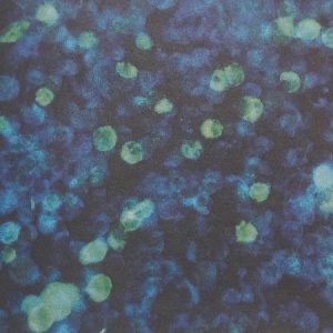 mononucleoza-infectioasa