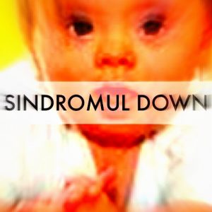 sindromul-down
