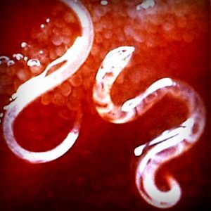 viermi-intestinali-paraziti