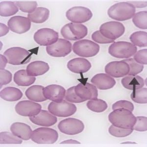 mycoplasma